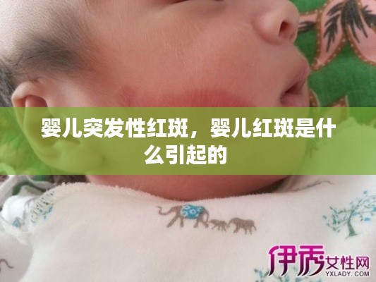 婴儿突发性红斑,婴儿红斑是什么引起的